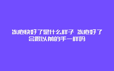 冻疮快好了是什么样子 冻疮好了会跟以前的手一样吗